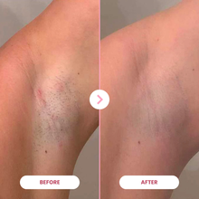 Ladda upp bild till gallerivisning, 1x Epilator